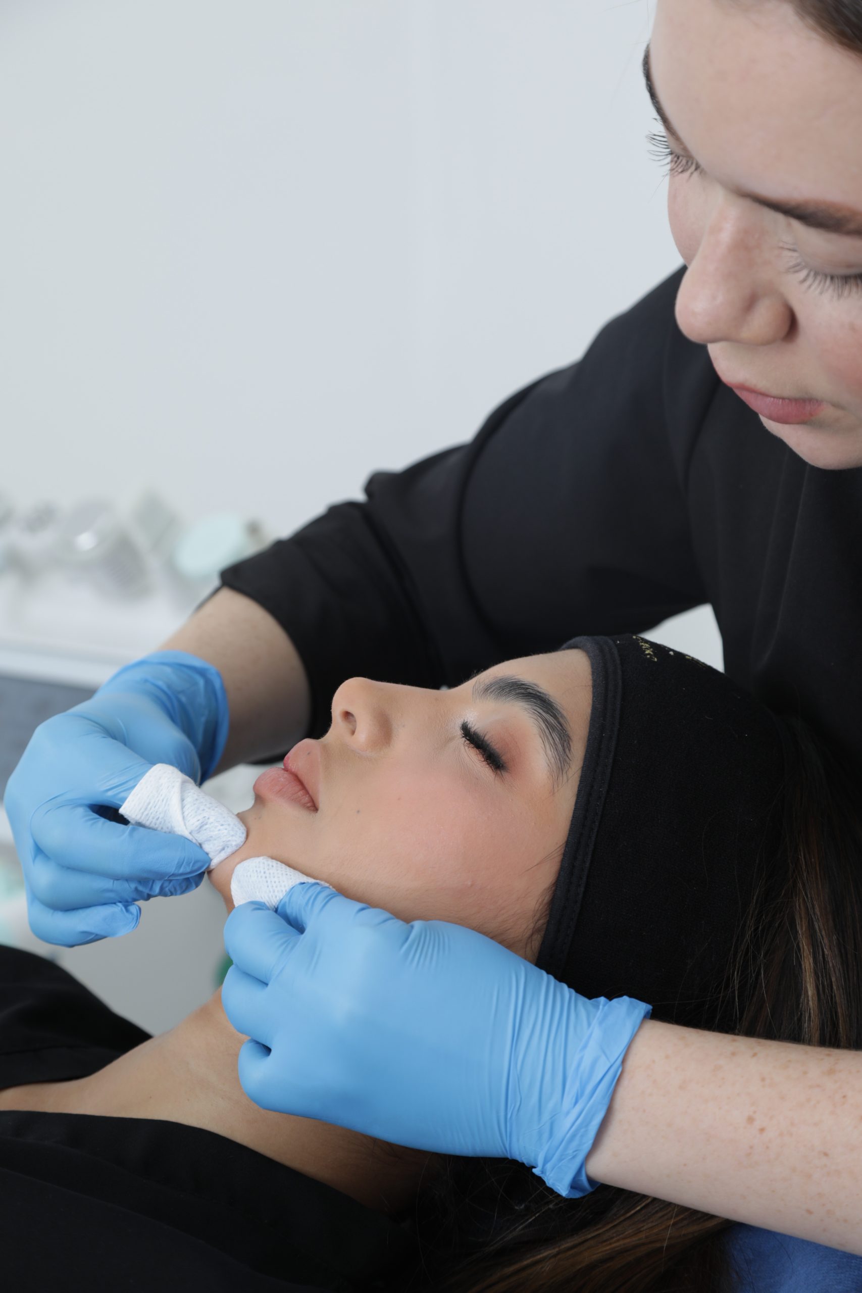 Limpieza facial anti acné - Imagen 2