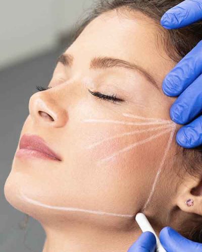 Armonización facial